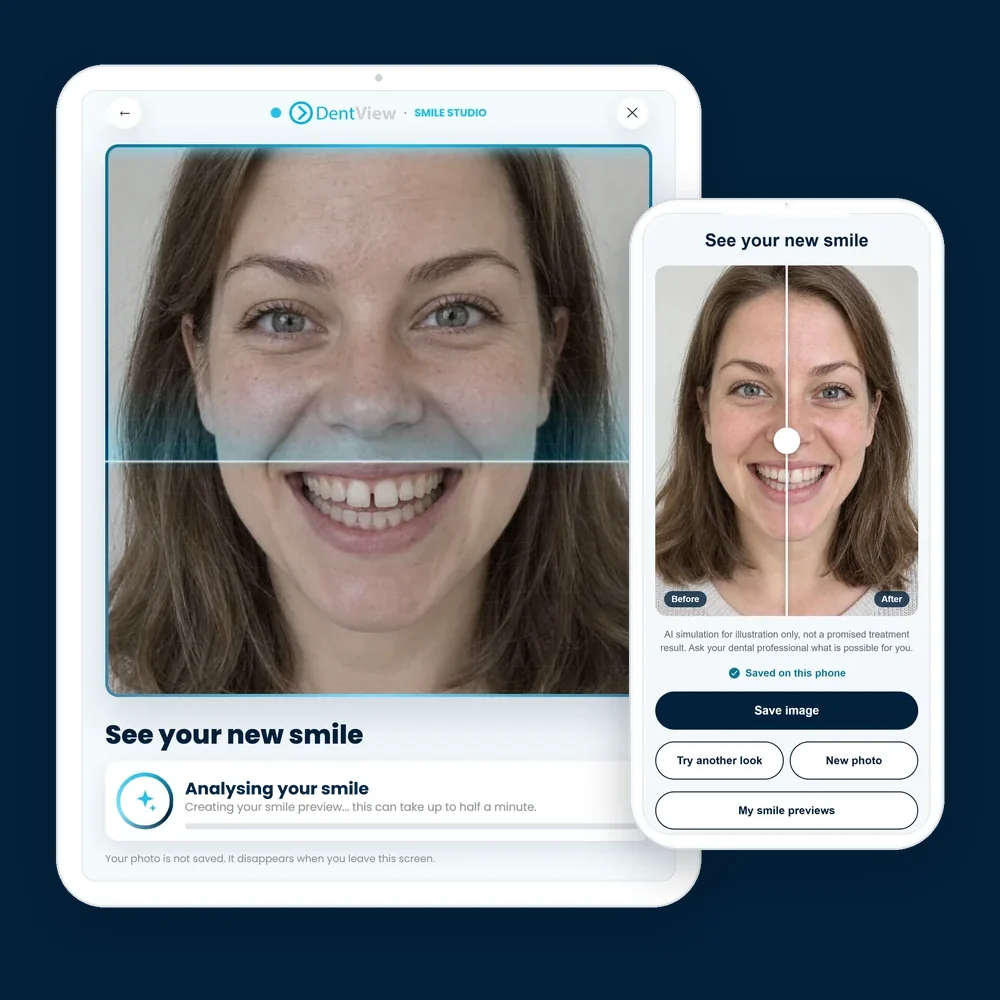 Smile Preview on a tablet and the before-and-after result on a phone