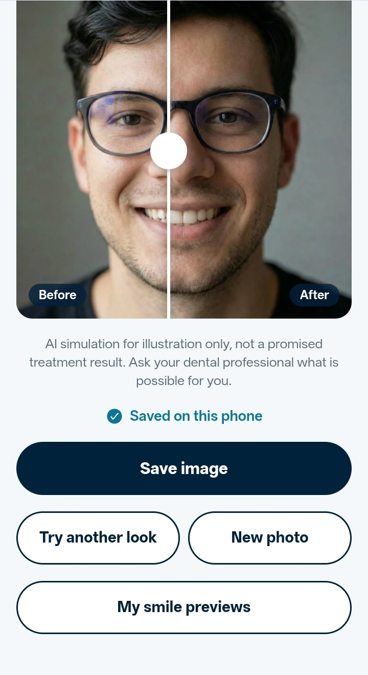 Smile Preview before-and-after result on a white iPhone
