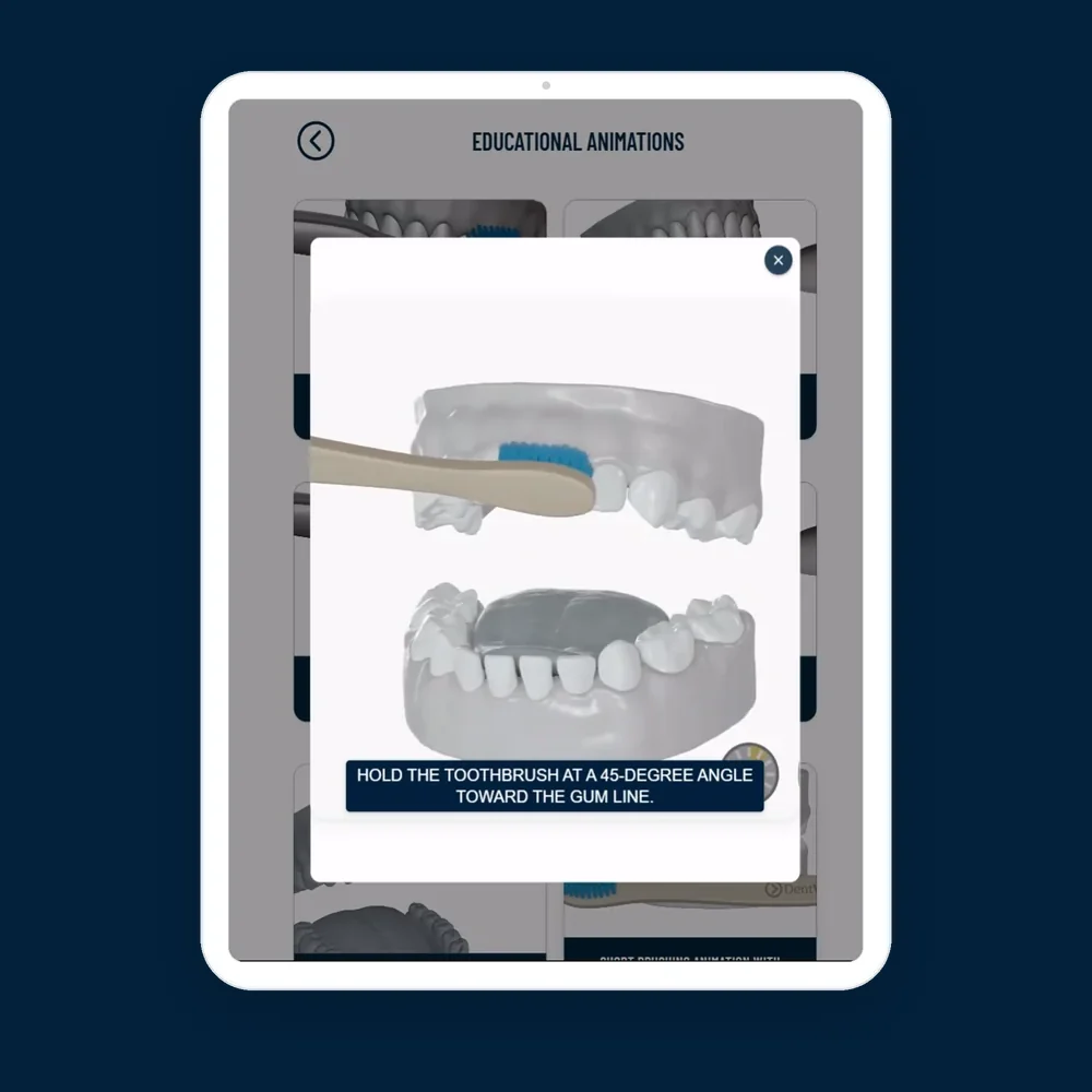 Self-care guide showing the correct toothbrush angle