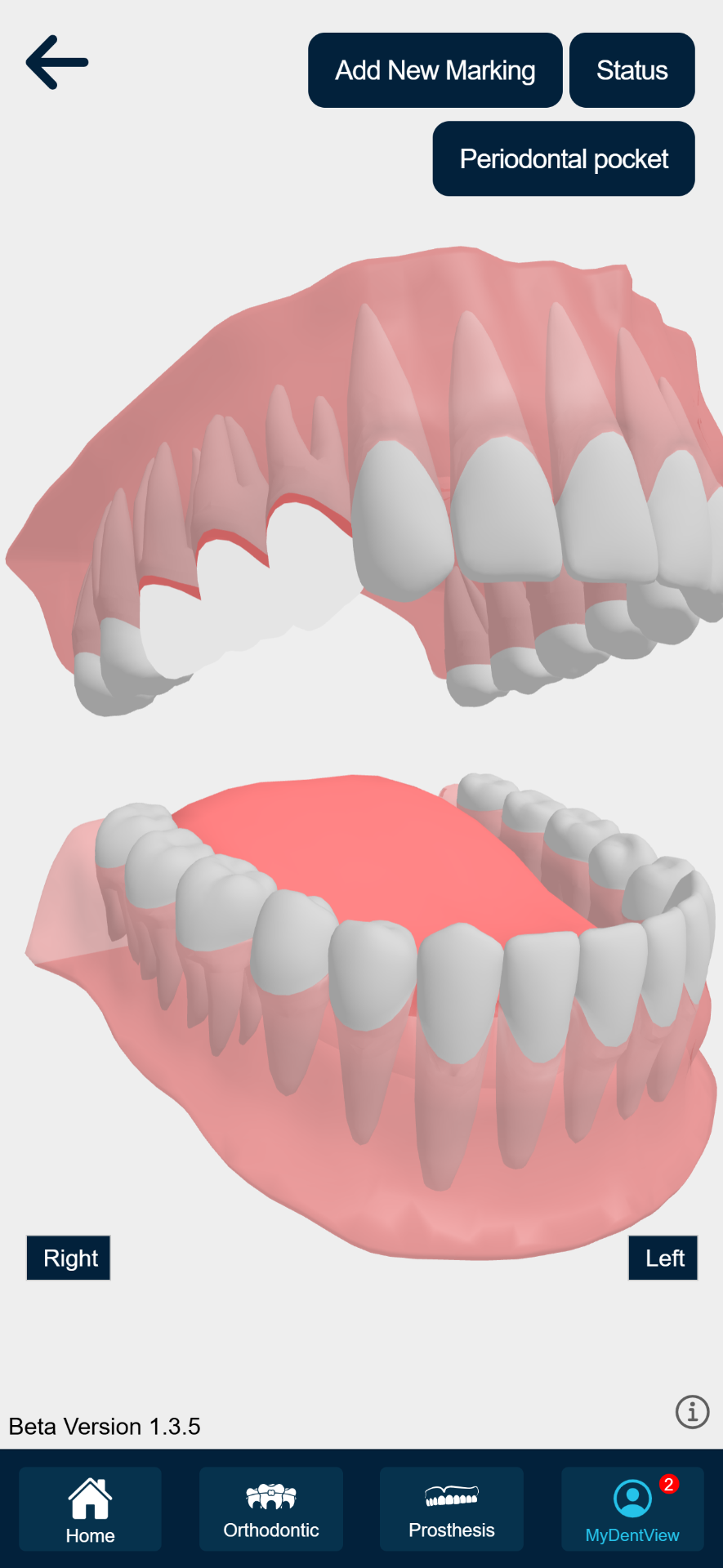 MyDentView 3D dental status view on a phone